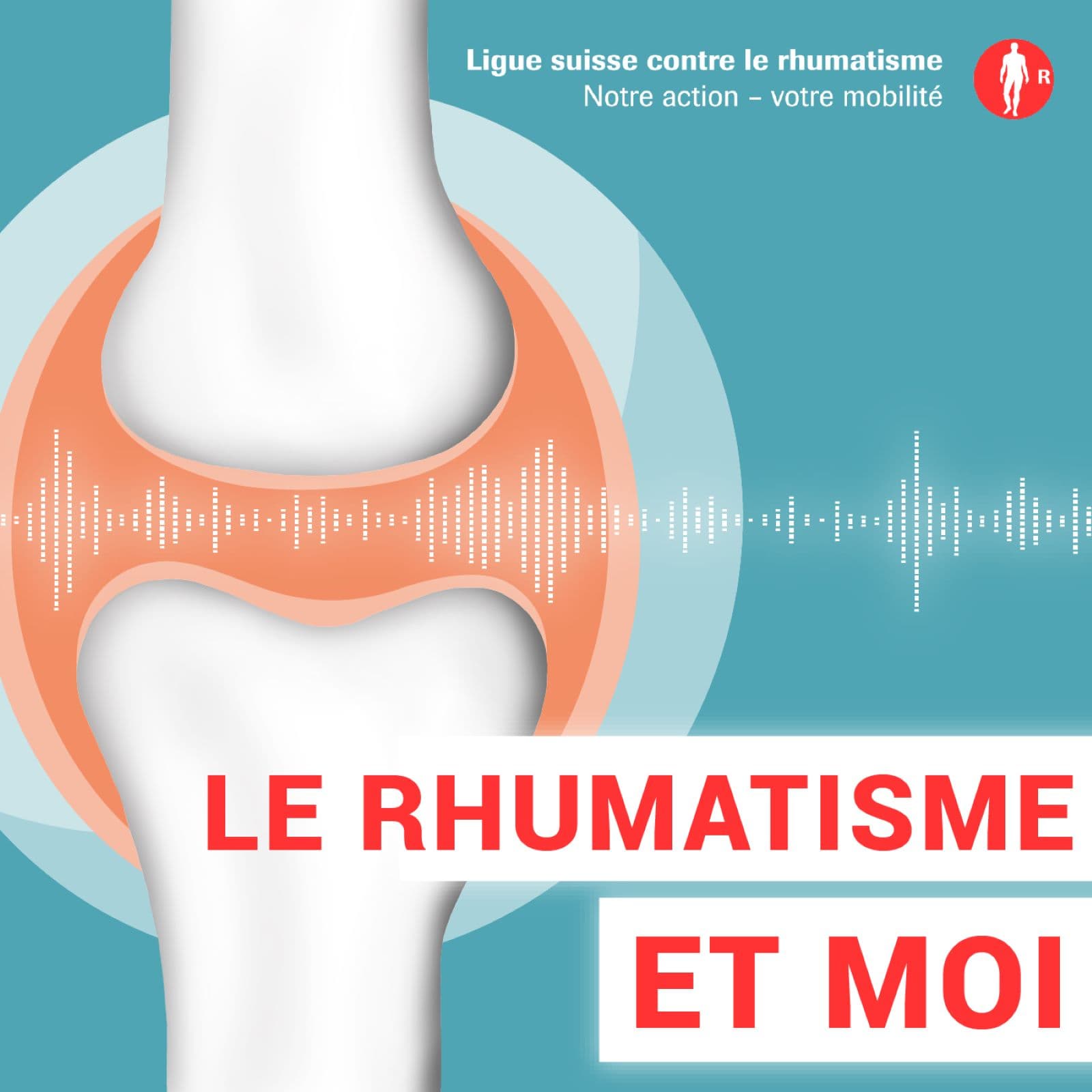 Le rhumatisme et moi - Podcasts
