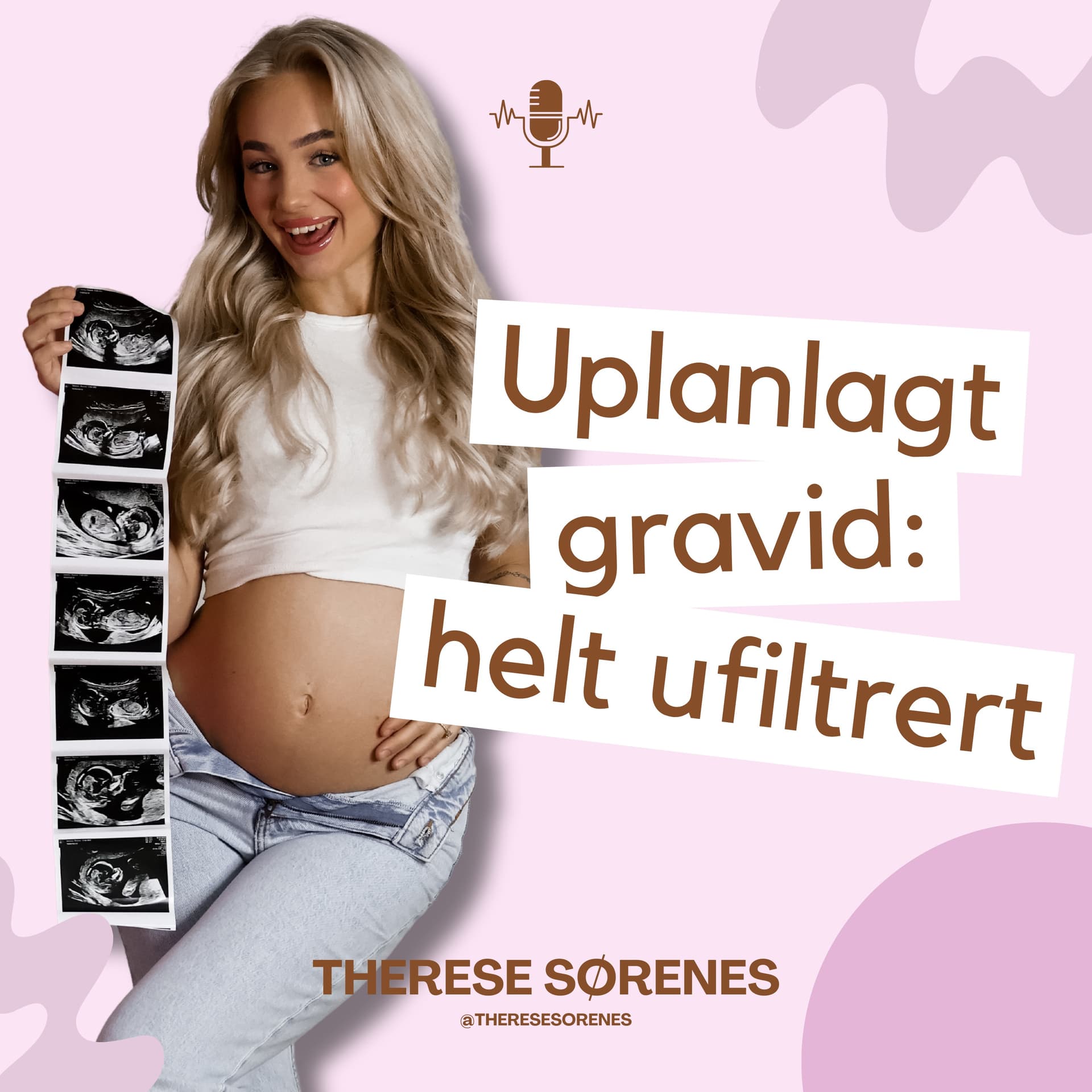 Uplanlagt gravid: helt ufiltrert - Podcasts