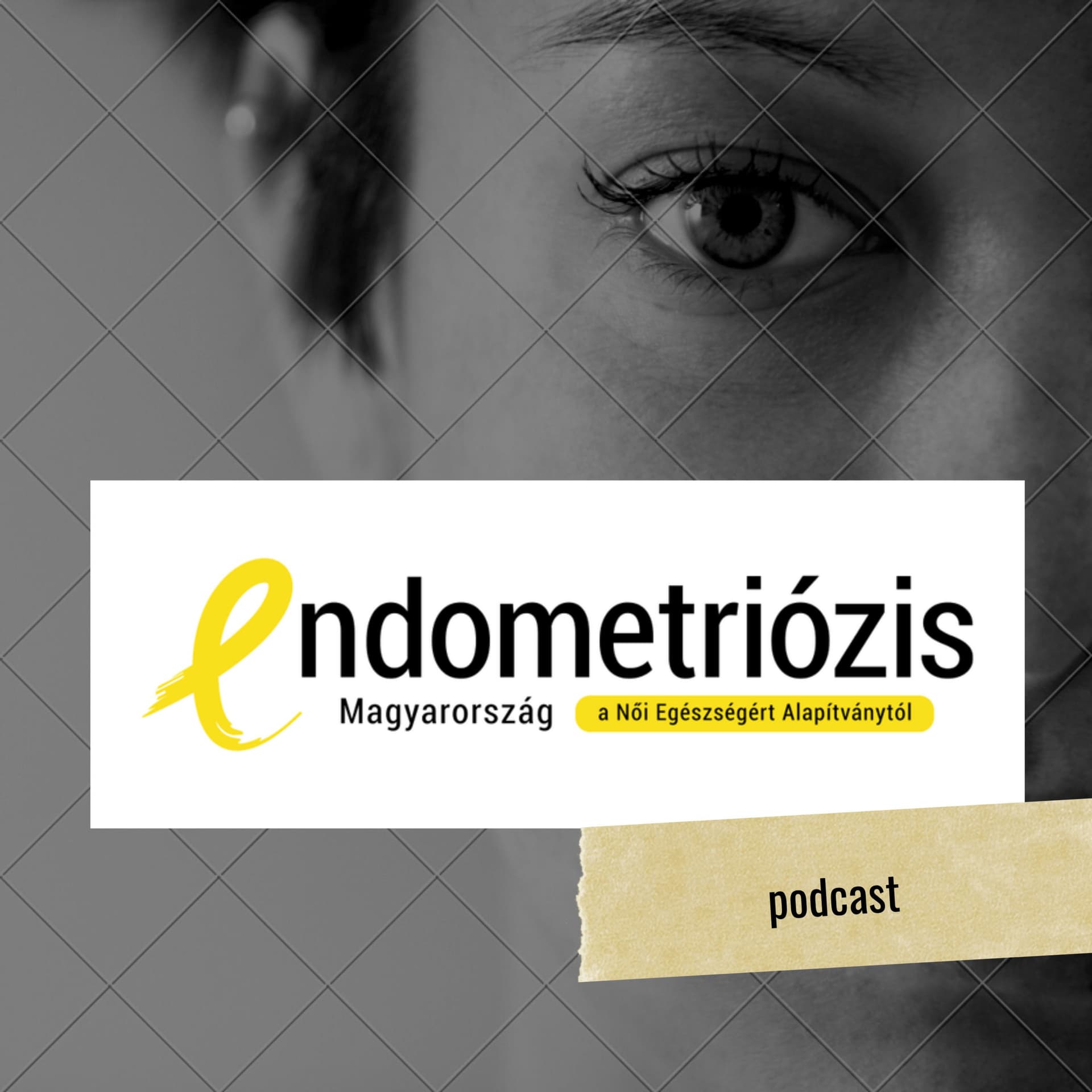 Endometriózis Magyarország Podcast - Podcast