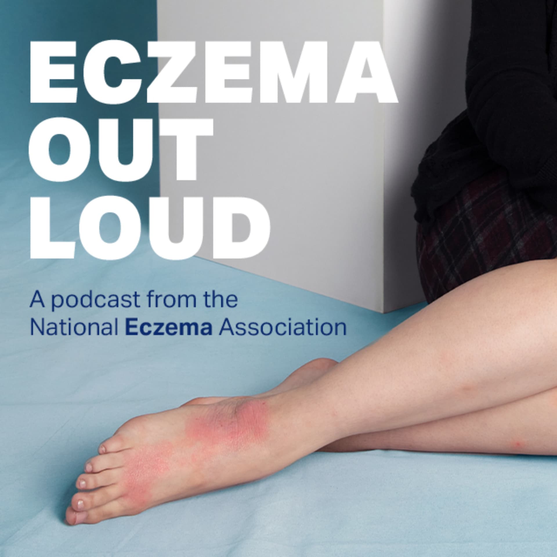 Eczema Out Loud - Podcasts