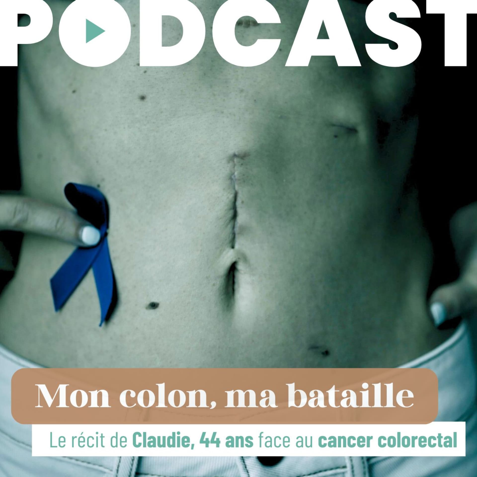 Mon colon ma bataille : le récit de Claudie, 44 ans, face au cancer colorectal - Podcast
