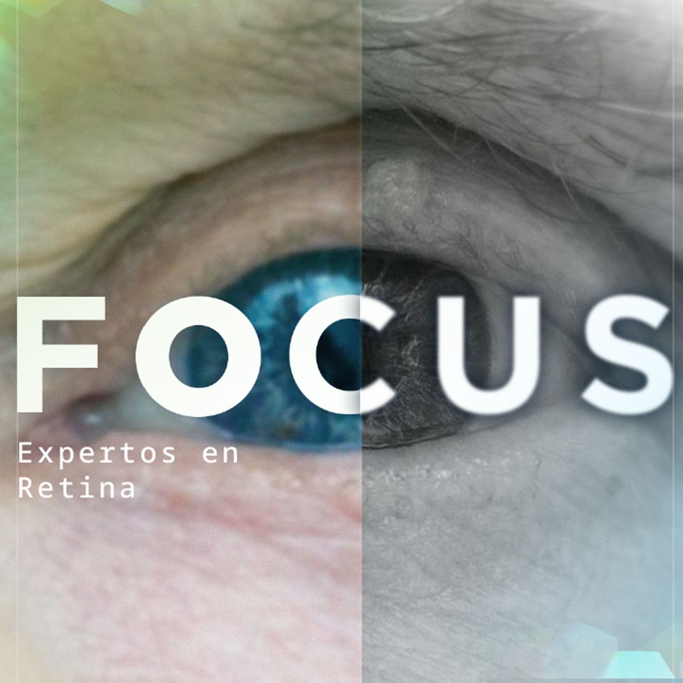 Focus, expertos en retina, by Bayer - Podcasts
