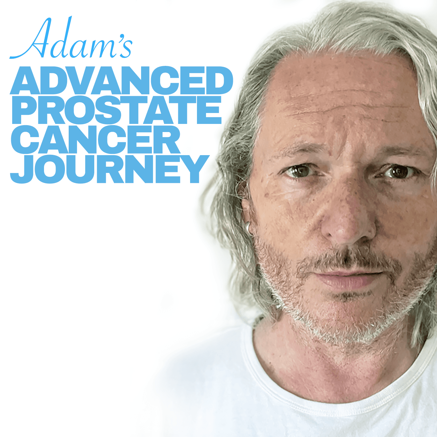 Adam’s Advanced Prostate Cancer Journey - Podcasts