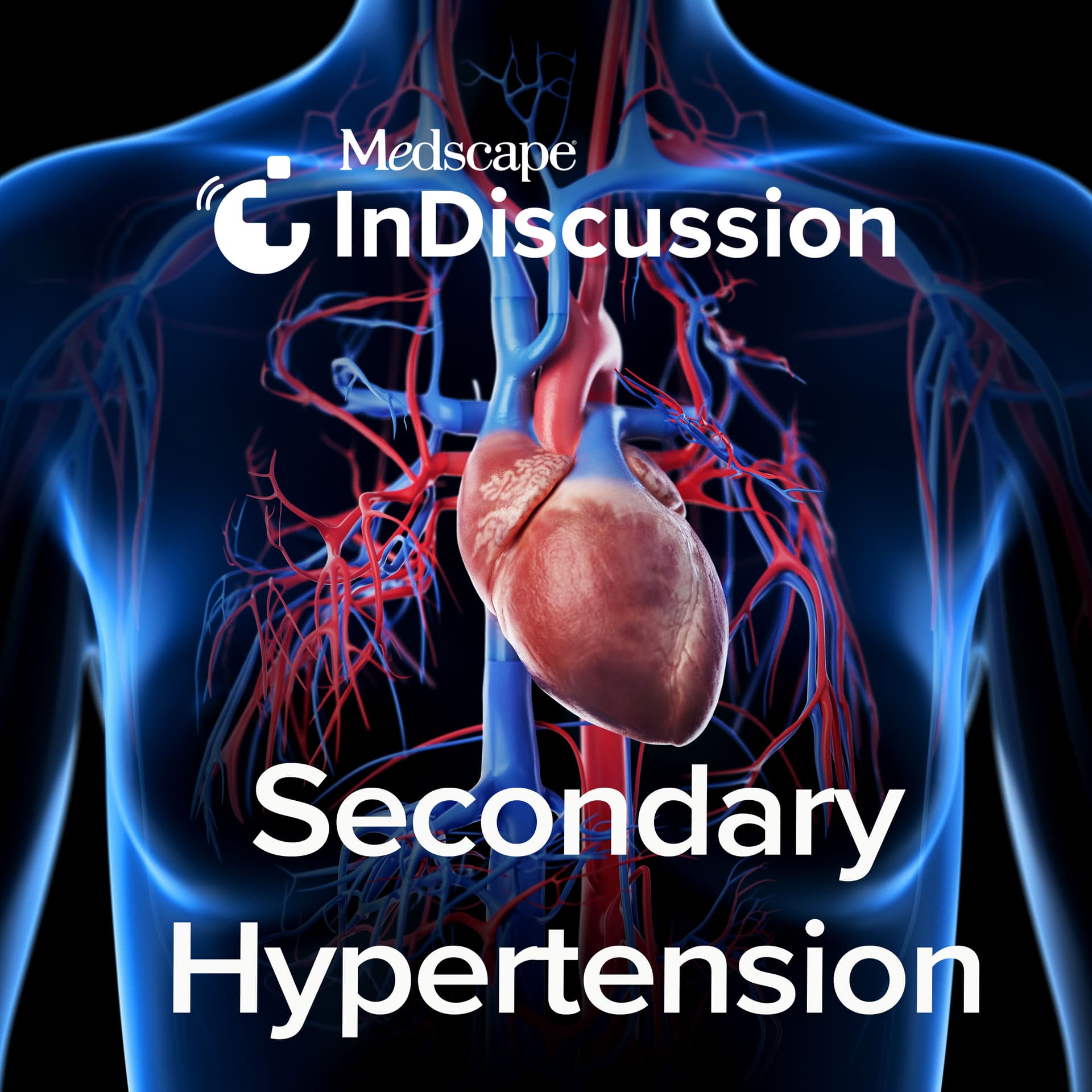 Medscape InDiscussion: Secondary Hypertension - Podcasts