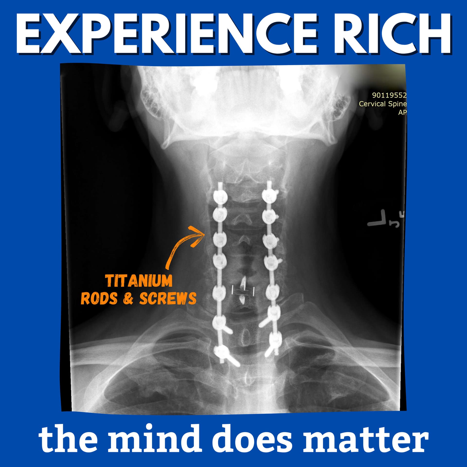 Experience Rich - Podcasts